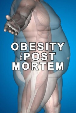 Obesity: The Post Mortem (2016) Obesity: The Post Mortem (2016)