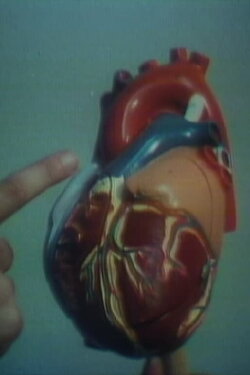 Open Heart Surgery (1975) Open Heart Surgery (1975)
