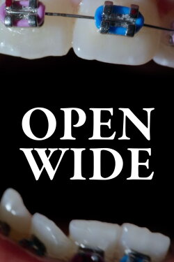Open Wide (2024) Open Wide (2024)