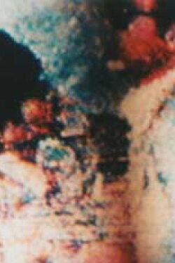 Passion Triptych (1982)