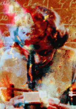 Pigment-Dispersion Syndrome (2022) Pigment-Dispersion Syndrome (2022)