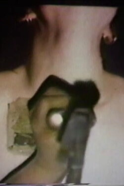 Renovations (1980)