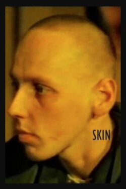 Skin (1995) Skin (1995)
