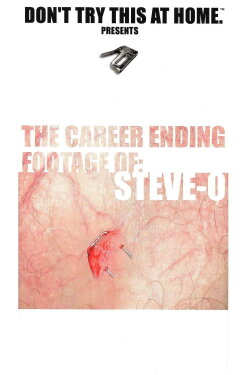 The Career Ending Footage of: Steve-O (2001)