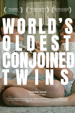 The World's Oldest Conjoined Twins (2009) The World's Oldest Conjoined Twins (2009)