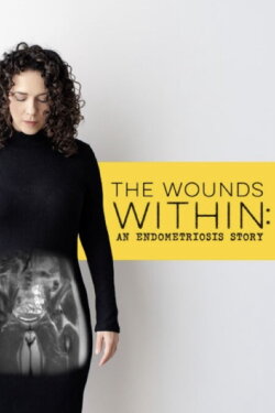 The Wounds Within: An Endometriosis Story (2024) The Wounds Within: An Endometriosis Story (2024)