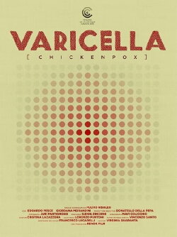 Varicella (2015) Varicella (2015)