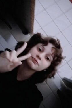 MIGS