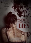 Where the Skin Lies (2017)