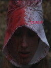 Scalp (2009)