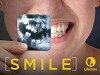 Smile (2015)