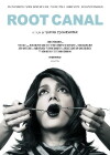 Root Canal (2013)