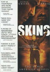 Skins (2002)