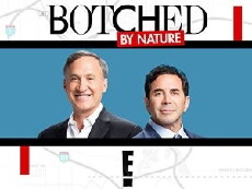 Botched by Nature (2016) - Stream Online