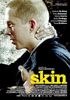 Skin - Hass war sein Ausweg (2008) - Stream Online