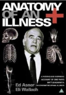 Anatomy of an Illness (1984) - Stream Online