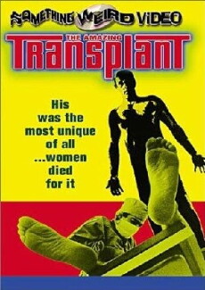 The Amazing Transplant (1970) - Stream Online